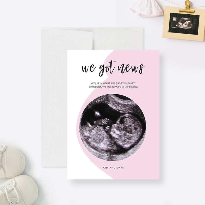 Pregnancy Announcement Editable Template, Pregnant Belly Digital Download, Baby Ultrasound Scan, We Got News, We Are Pregnant