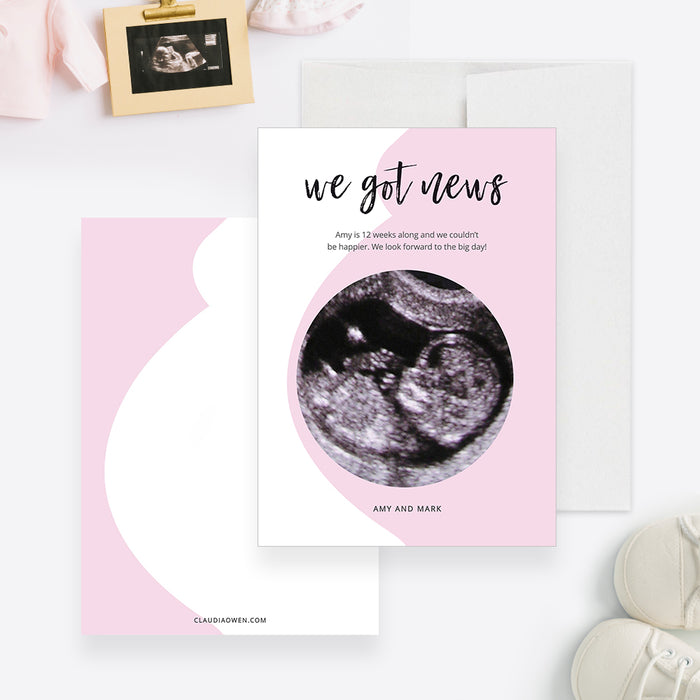 Pregnancy Announcement Editable Template, Pregnant Belly Digital Download, Baby Ultrasound Scan, We Got News, We Are Pregnant